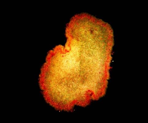 How One of the Simplest Animals Precisely Folds Itself