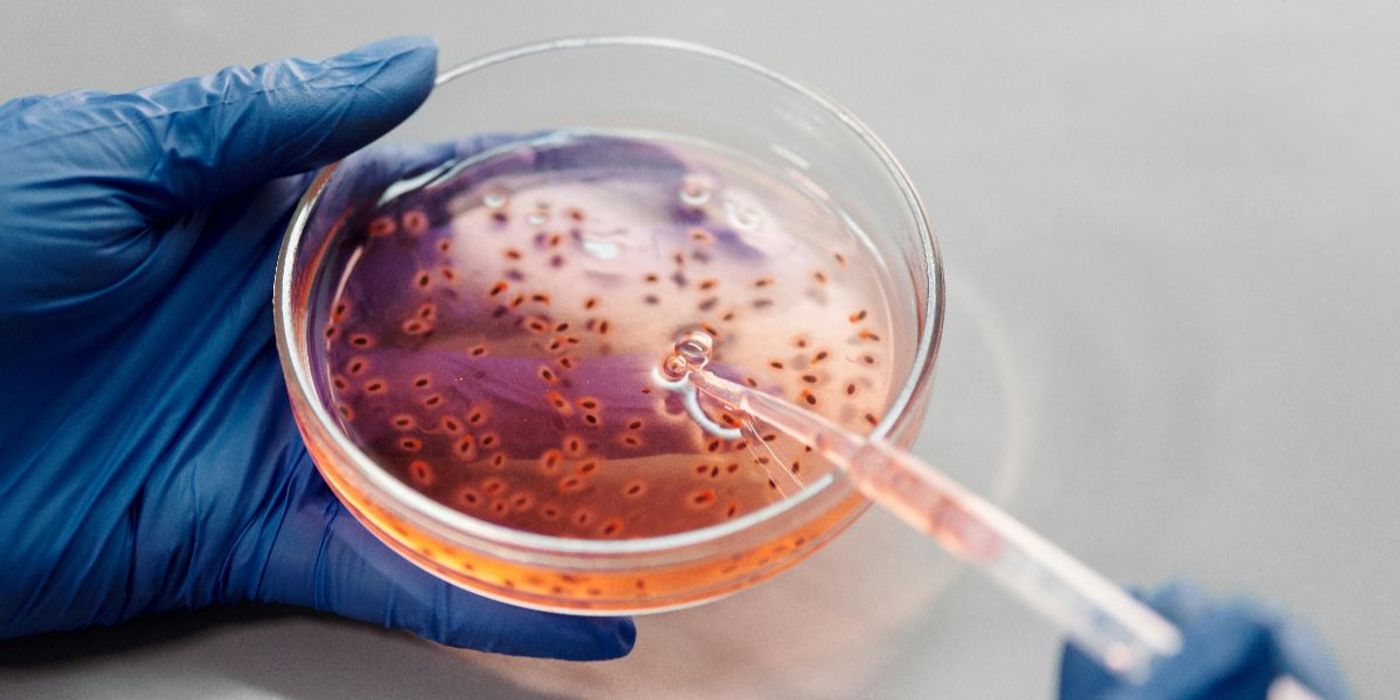 Delafloxacin Shows Promise Against Severe Pneumonia