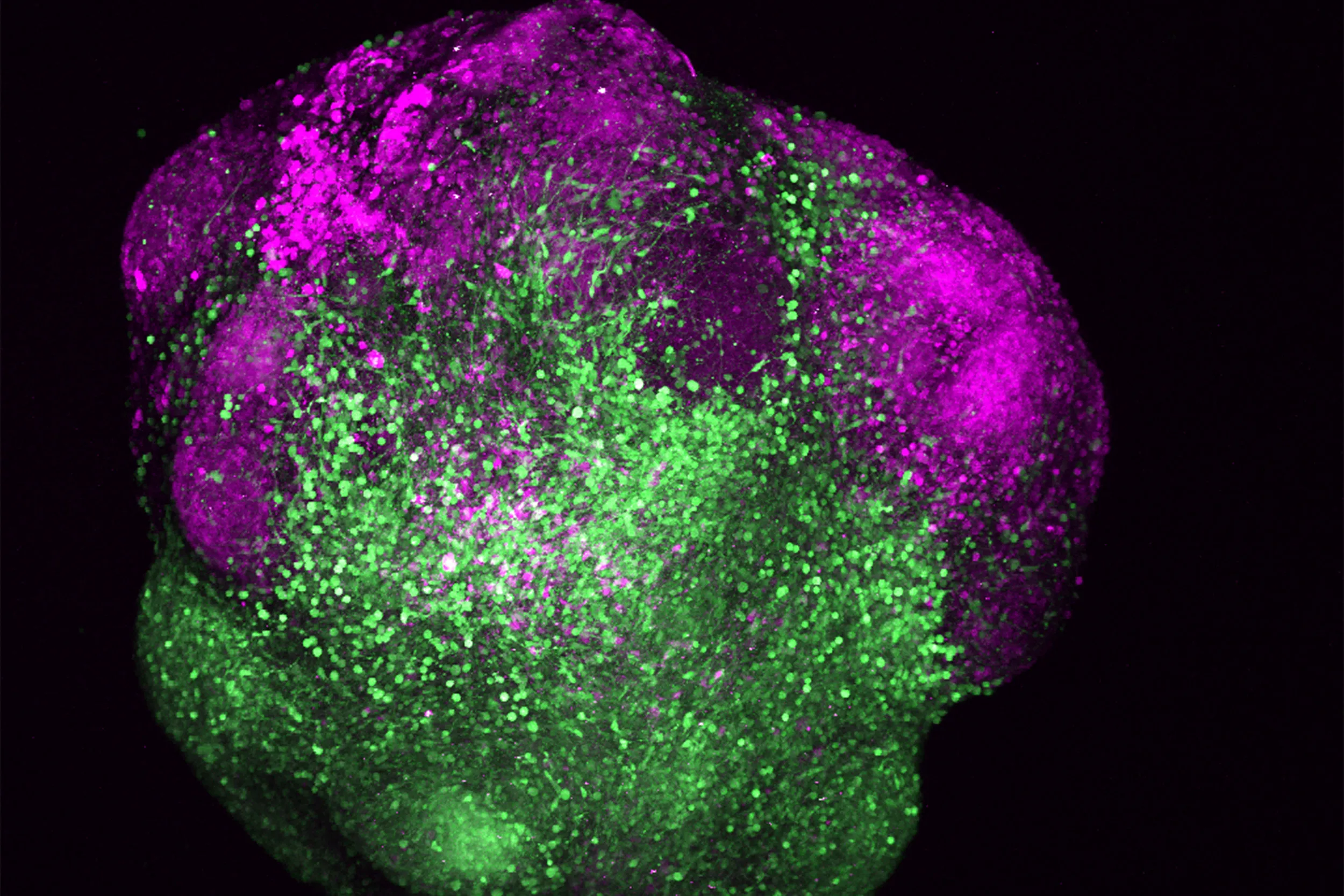 Seeding solutions for bipolar disorder — Harvard Gazette