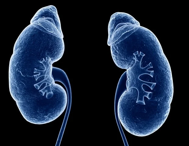 Study reveals hidden bacterial role in the formation of most kidney stones