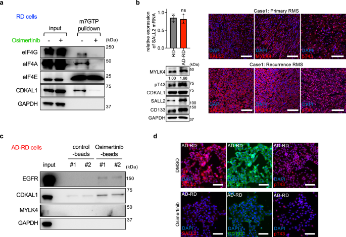 Osimertinib inhibits the MYLK4-mediated phosphorylation of CDKAL1 to suppress stemness and chemoresistance in rhabdomyosarcoma