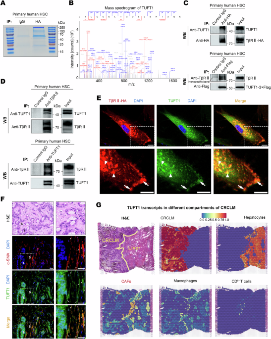 TUFT1 stabilizes TGF-β receptor II protein and facilitates activation of hepatic stellate cells into metastasis-promoting myofibroblasts