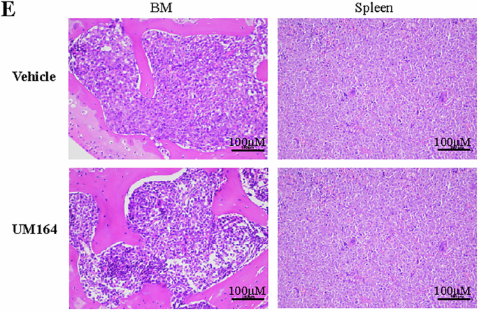 Correction: UHRF1-mediated epigenetic reprogramming regulates glycolysis to promote progression of B-cell acute lymphoblastic leukemia