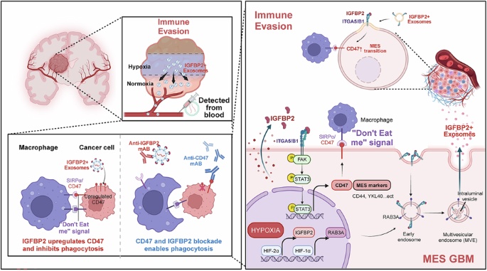 Targeting hypoxic exosomal IGFBP2 overcomes CD47-mediated immune evasion in glioblastoma