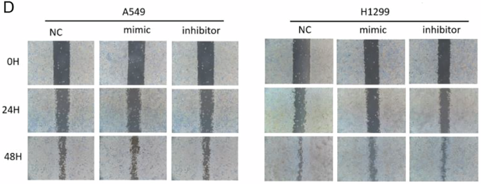 Correction: Tumor-derived exosomal tsRNA 3′tiRNA-AlaCGC in promoting fibroblast senescence and Galectin-9 secretion to induce immune tolerance in lung adenocarcinoma