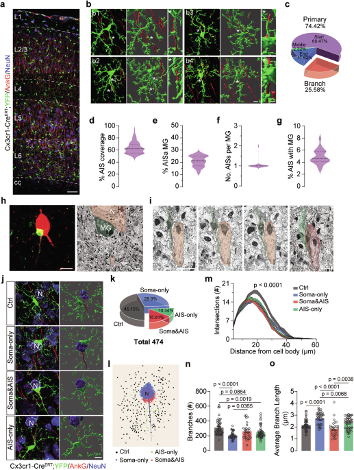 The axon initial segment-associated microglia regulate neuronal activity and visual perception