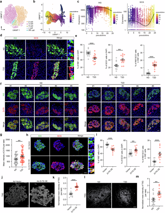 Zinc accumulation-induced integrated stress response triggers β-cell identity loss