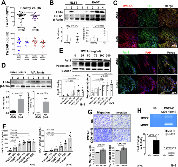 TWEAK receptor (Fn14) exacerbates TNF-α-induced inflammation in rheumatoid arthritis synovial fibroblasts and influences response to anti-TNF-α therapy