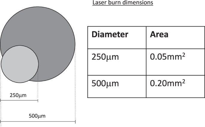 Short-pulse multi-spot PRP, burn size and the risk of undertreatment