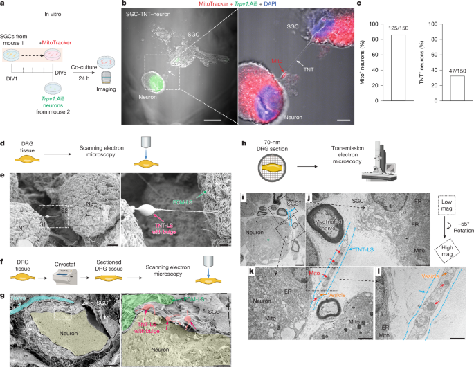 Mitochondrial transfer from glia to neurons protects against peripheral neuropathy