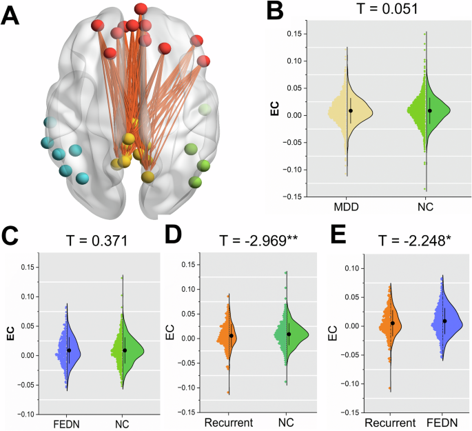 Beyond depression symptoms: the default mode network as a predictor of antidepressant response