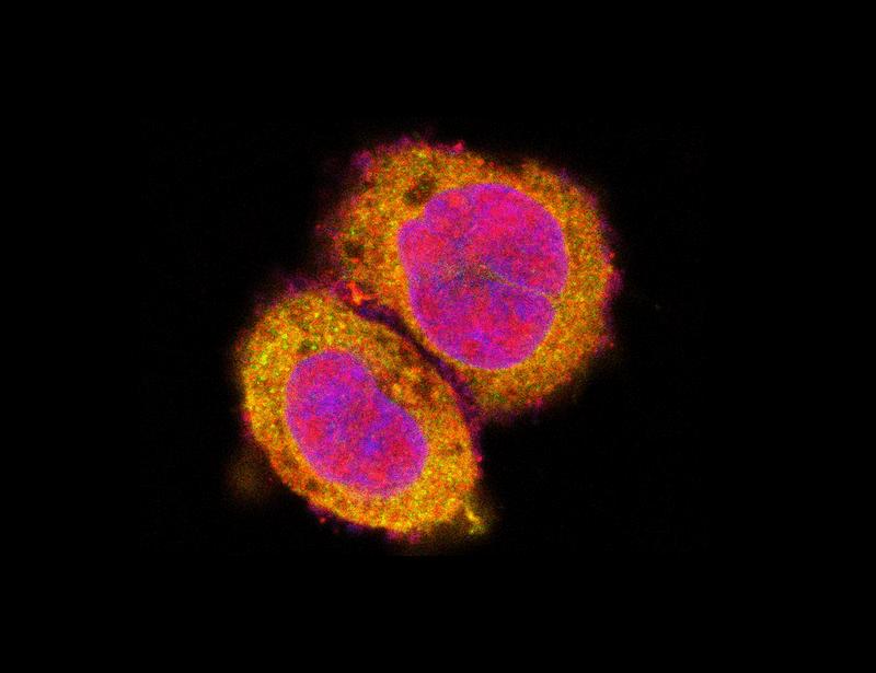 Human OCEL1 senses bacterial infection to unlock inflammatory responses | Science Immunology