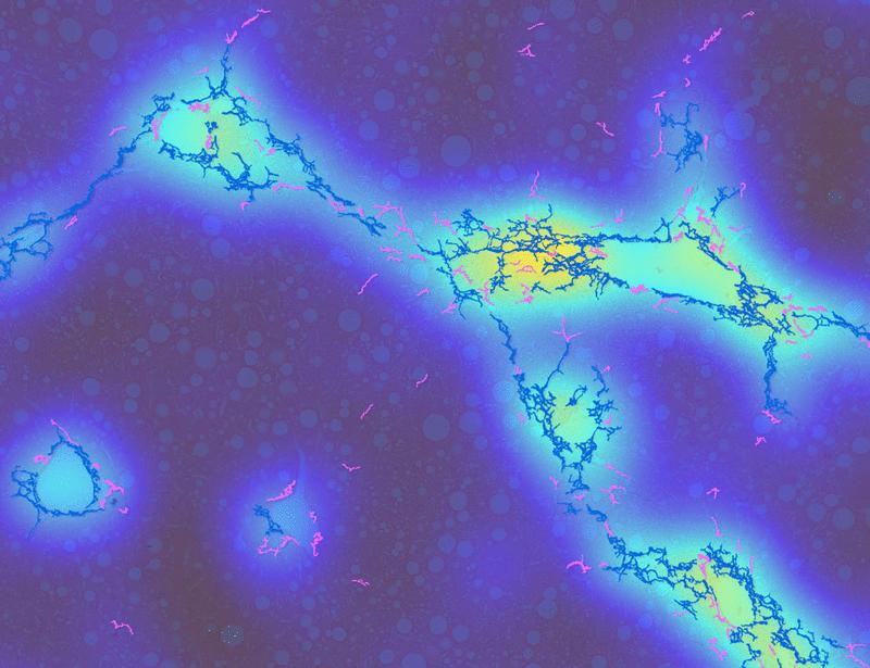Anti-FAP CAR T cells produced in vivo reduce fibrosis and restore liver homeostasis in metabolic dysfunction–associated steatohepatitis | Science Translational Medicine