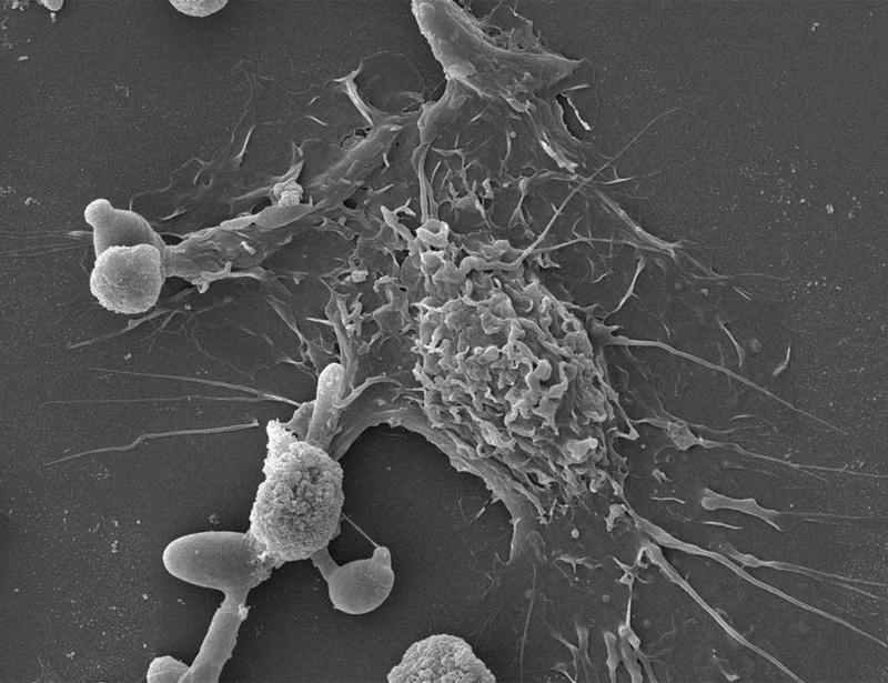 Meteorin-like is associated with poor outcome in invasive candidiasis in mouse models and in humans | Science Translational Medicine