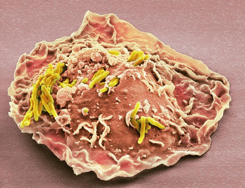 Mycobacterial α-glucans hijack dectin-1 to facilitate intracellular bacterial survival | Science Immunology