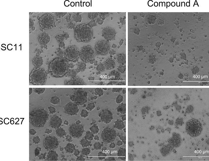 A first-in-class small-molecule inhibitor targeting AVIL exhibits safety and antitumor efficacy in preclinical models of glioblastoma | Science Translational Medicine