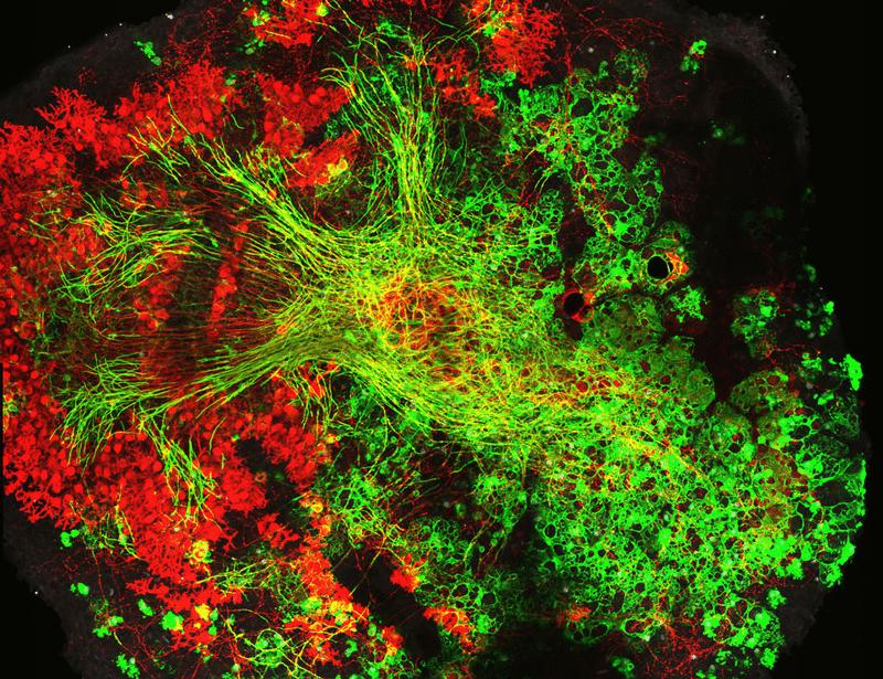 In silico screening and preclinical validation identify bavisant as a therapeutic candidate for multiple sclerosis | Science Translational Medicine