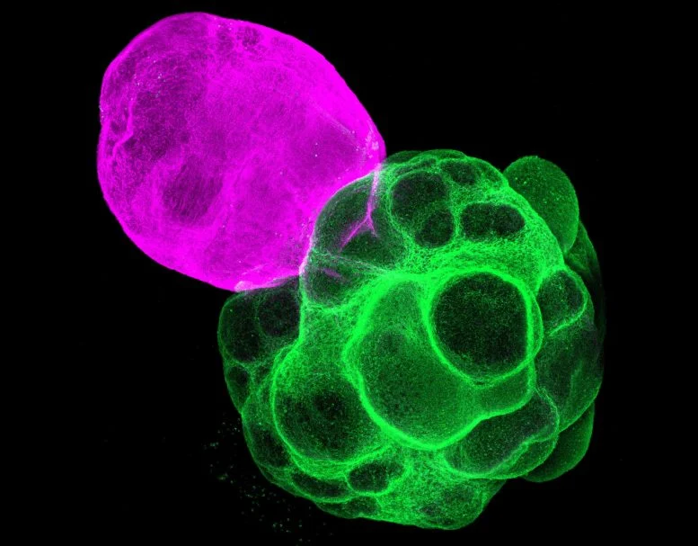 Mini Human Brains Reveal How the Brain Wires Itself