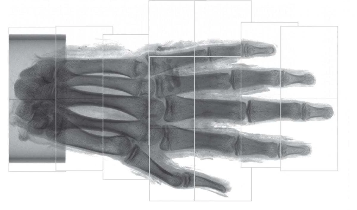 CT technique expands possibilities of imaging ancient remains