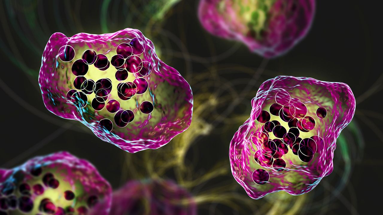 South Carolina’s measles outbreak is the largest since the US eliminated the disease