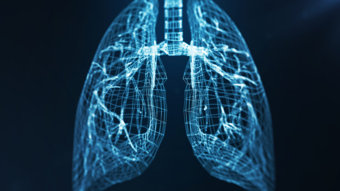 Custom machine kept man alive without lungs for 48 hours