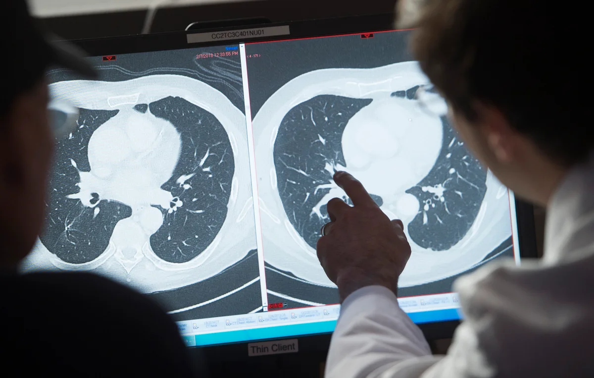 70 Percent of Cancer Patients Now Survive at Least Five Years, Study Finds