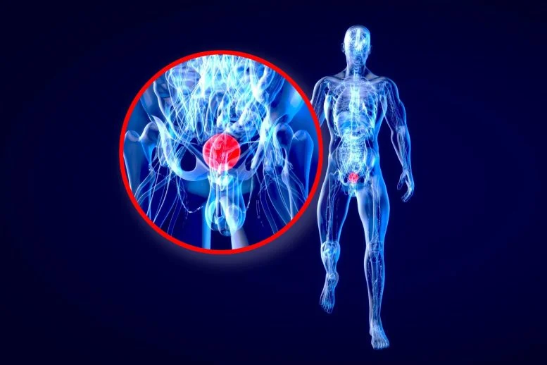 Stanford Study Reveals Colorblindness May Hide a Deadly Cancer Warning