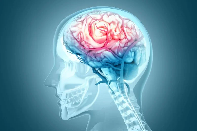 This Brain Condition Quadruples Dementia Risk And Most People Have Never Heard of It