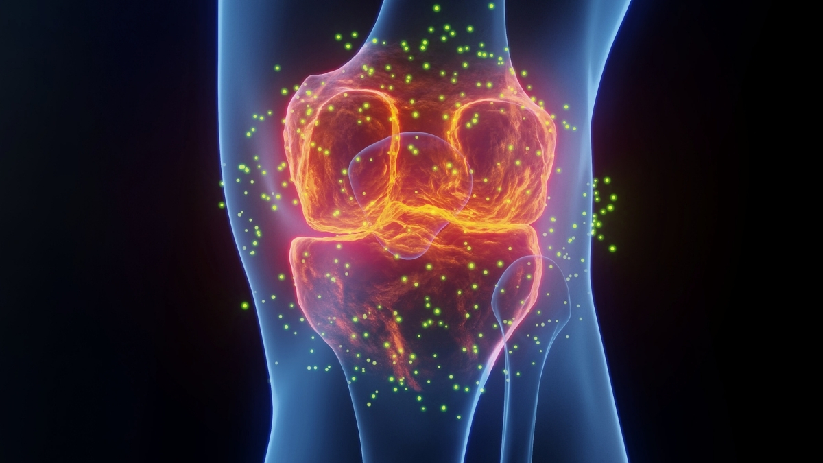 The Best Medicine For Joint Pain Isn’t What You Think, Says Expert : ScienceAlert