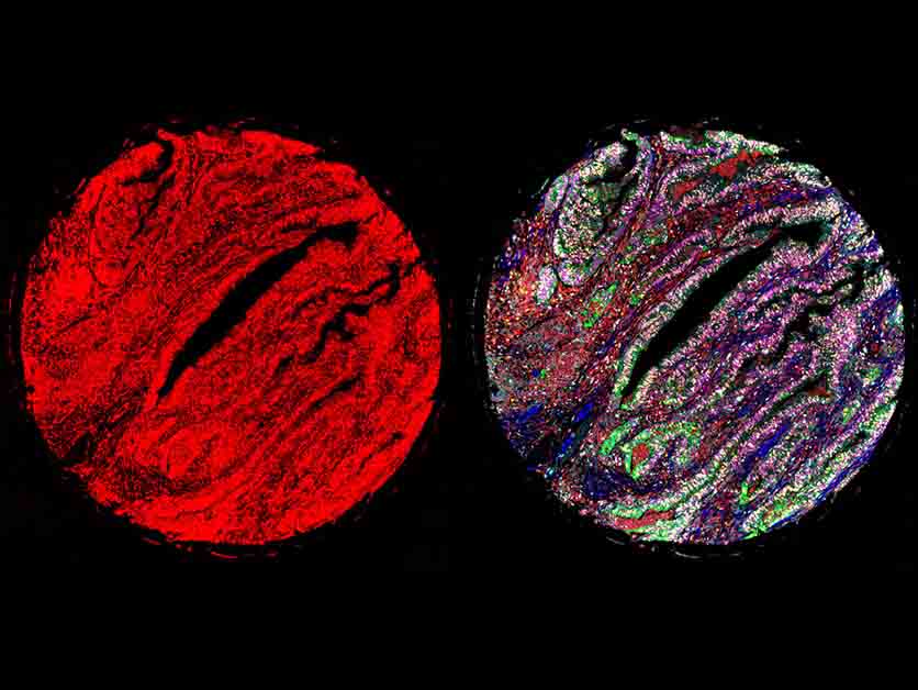 Multiple Proteins Viewed as Never Before – Life Sciences | Weizmann Wonder Wander