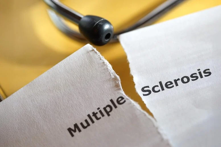Hidden Brain Damage Found Years Before MS Diagnosis