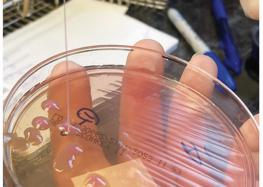 This may be the grossest eye pic ever—but the cause is what’s truly horrifying