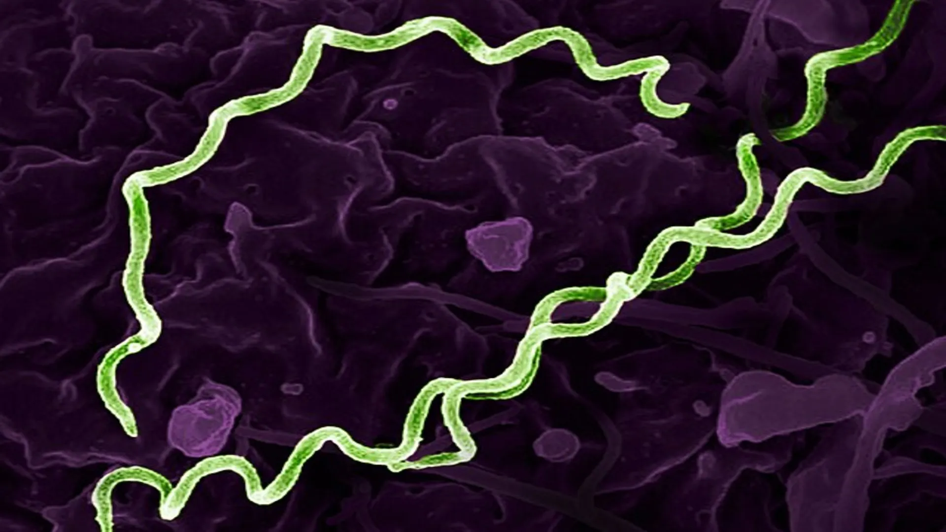 5,550-year-old man carries world’s oldest syphilis-related bacteria