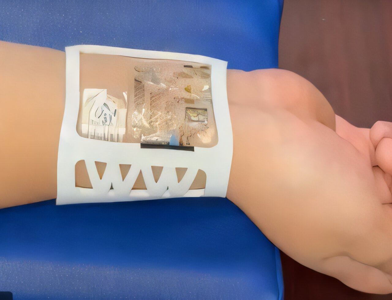 Bioelectronic wristband offers continuous, objective, real-time stress monitoring