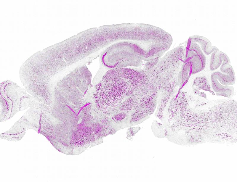 Restoration of progranulin by engineered hematopoietic stem cell–derived microglia corrects phenotypes of granulin knockout mice | Science Translational Medicine