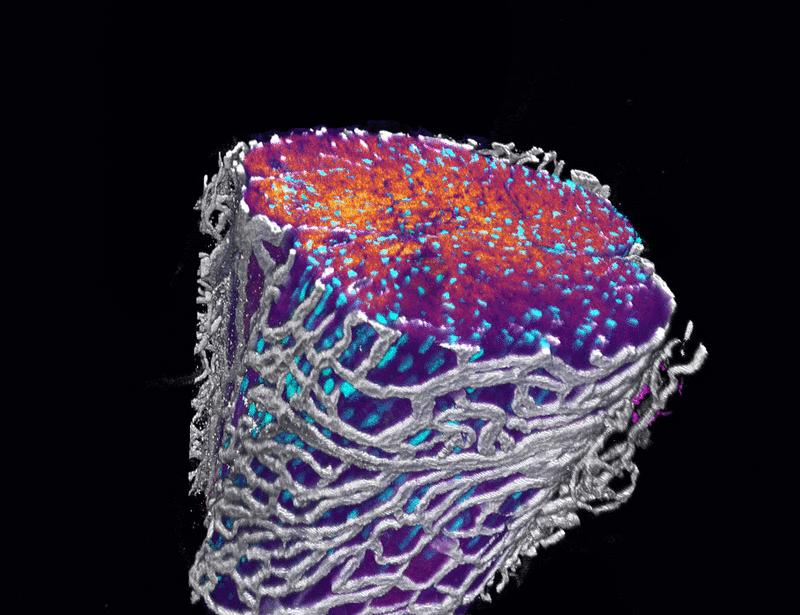 HIF1α gates tendon response to overload and drives tendinopathy independently of vascular recruitment | Science Translational Medicine