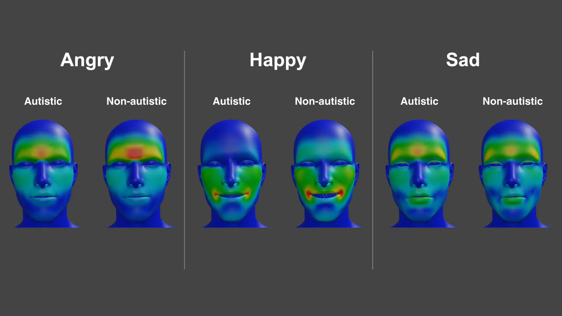 New research shows emotional expressions work differently in autism