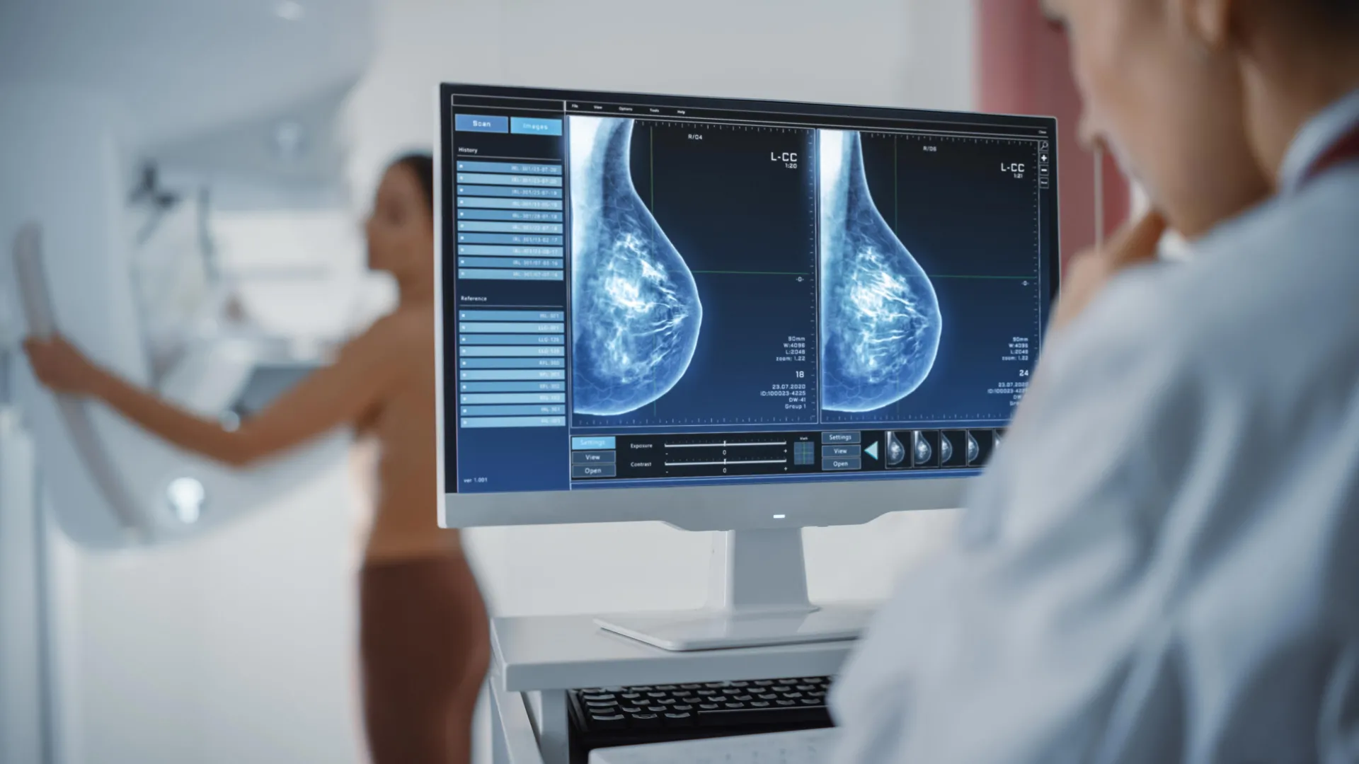 A smarter way to screen for breast cancer is emerging