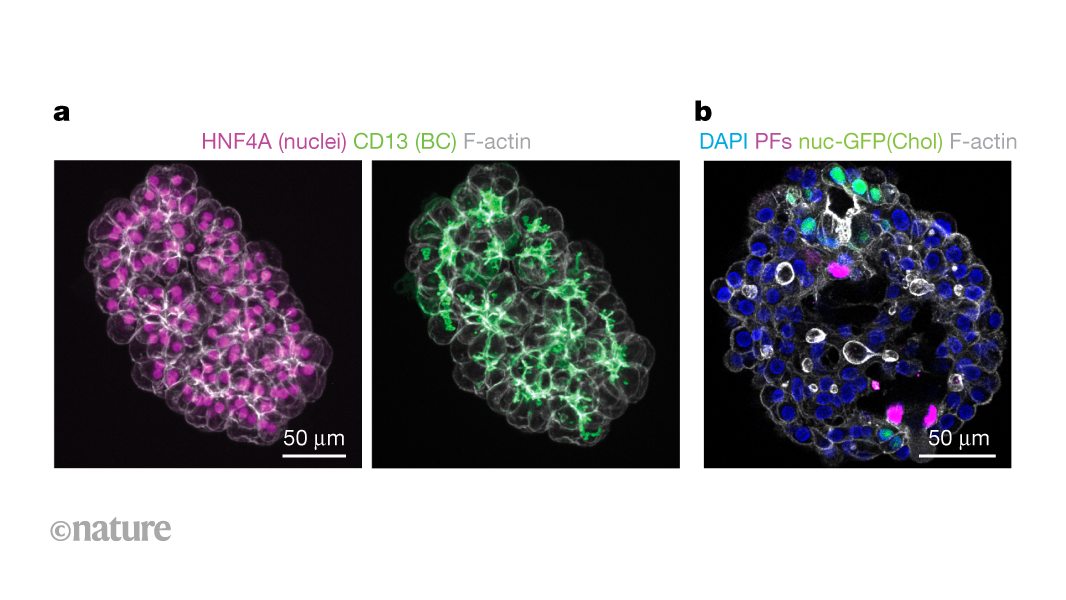 A step towards building miniature human livers