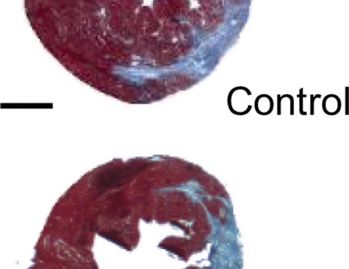 Extracellular BRICK1 drives heart repair after myocardial infarction in mice | Science Translational Medicine