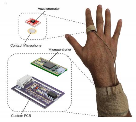 CMU Sensor Objectively Measures Scratching Intensity