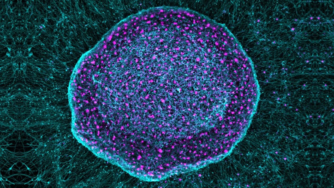 ‘Pain sponge’ derived from stem cells could soak up pain signals before they reach the brain