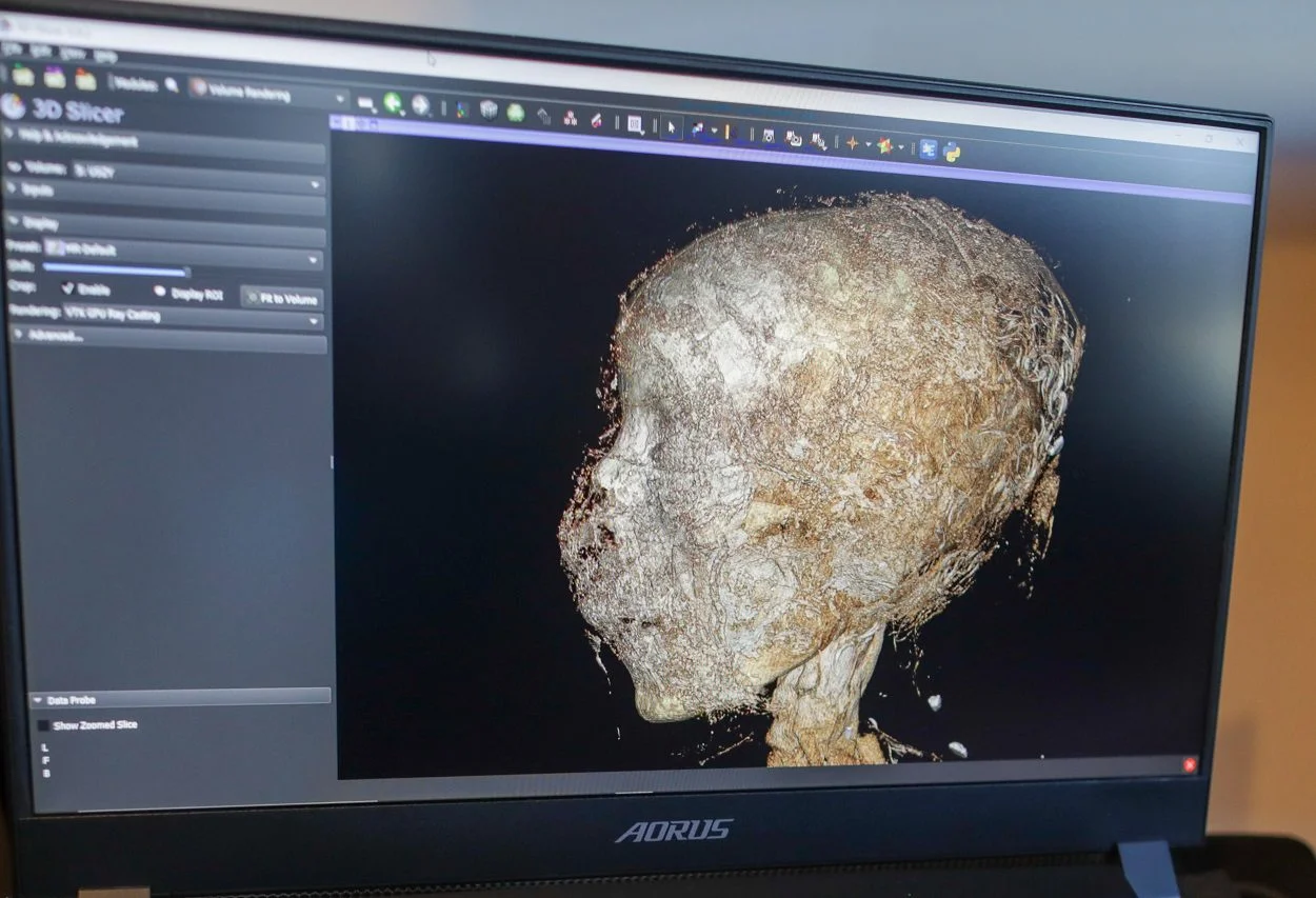 First pregnant Ancient Egyptian mummy revealed by study