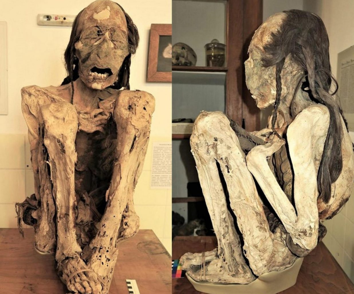 Scientists uncover crimes from a millennium ago in extreme cold case mummies