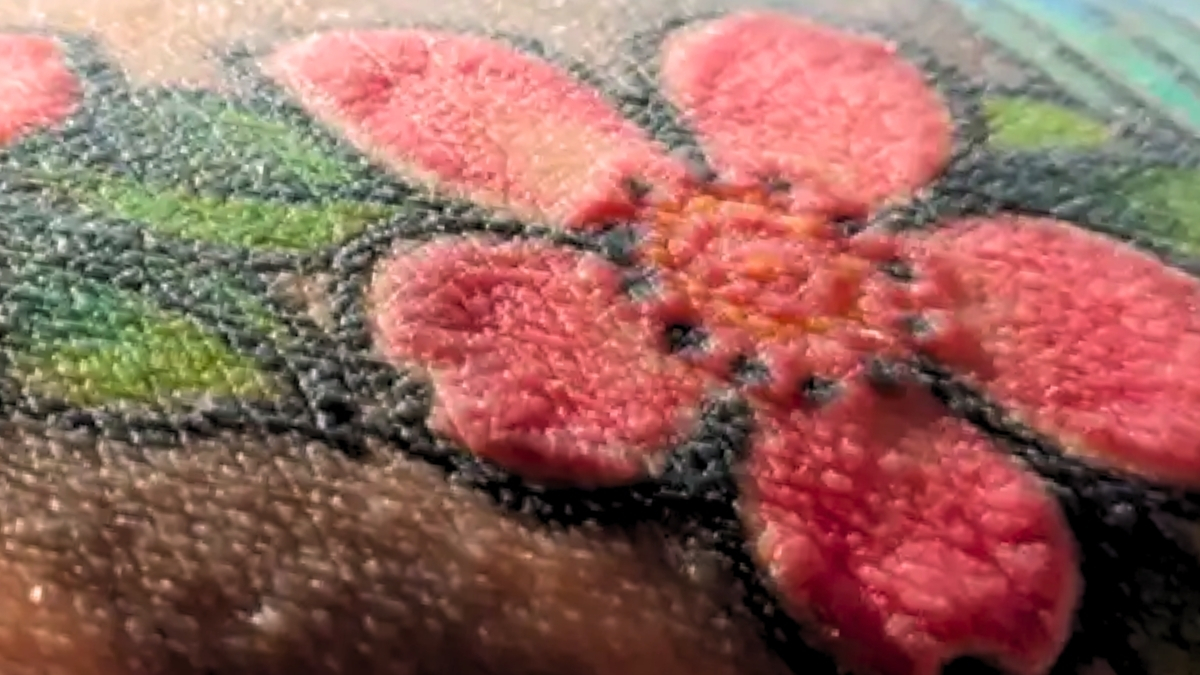 Red Tattoos Triggered Shocking Immune Reactions in Polish Man : ScienceAlert