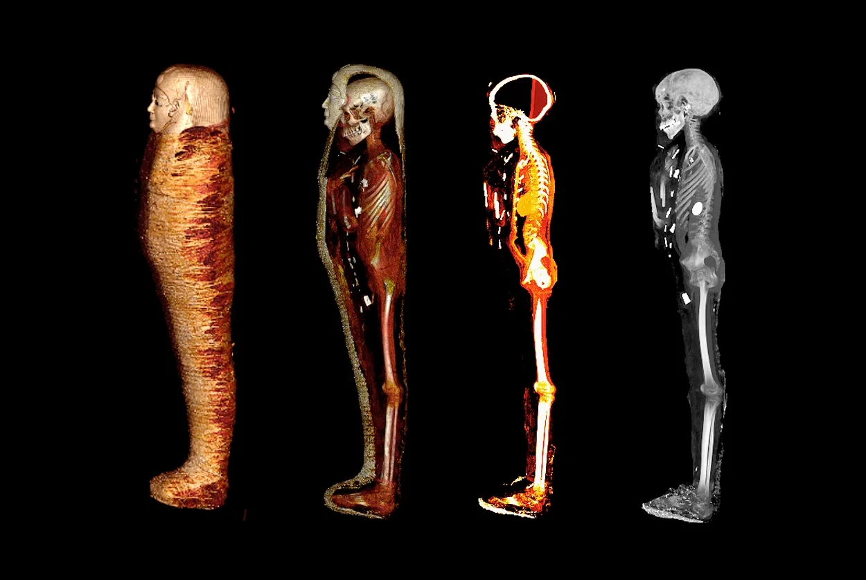 Ancient details of mummy’s hand revealed with advanced radiology technique