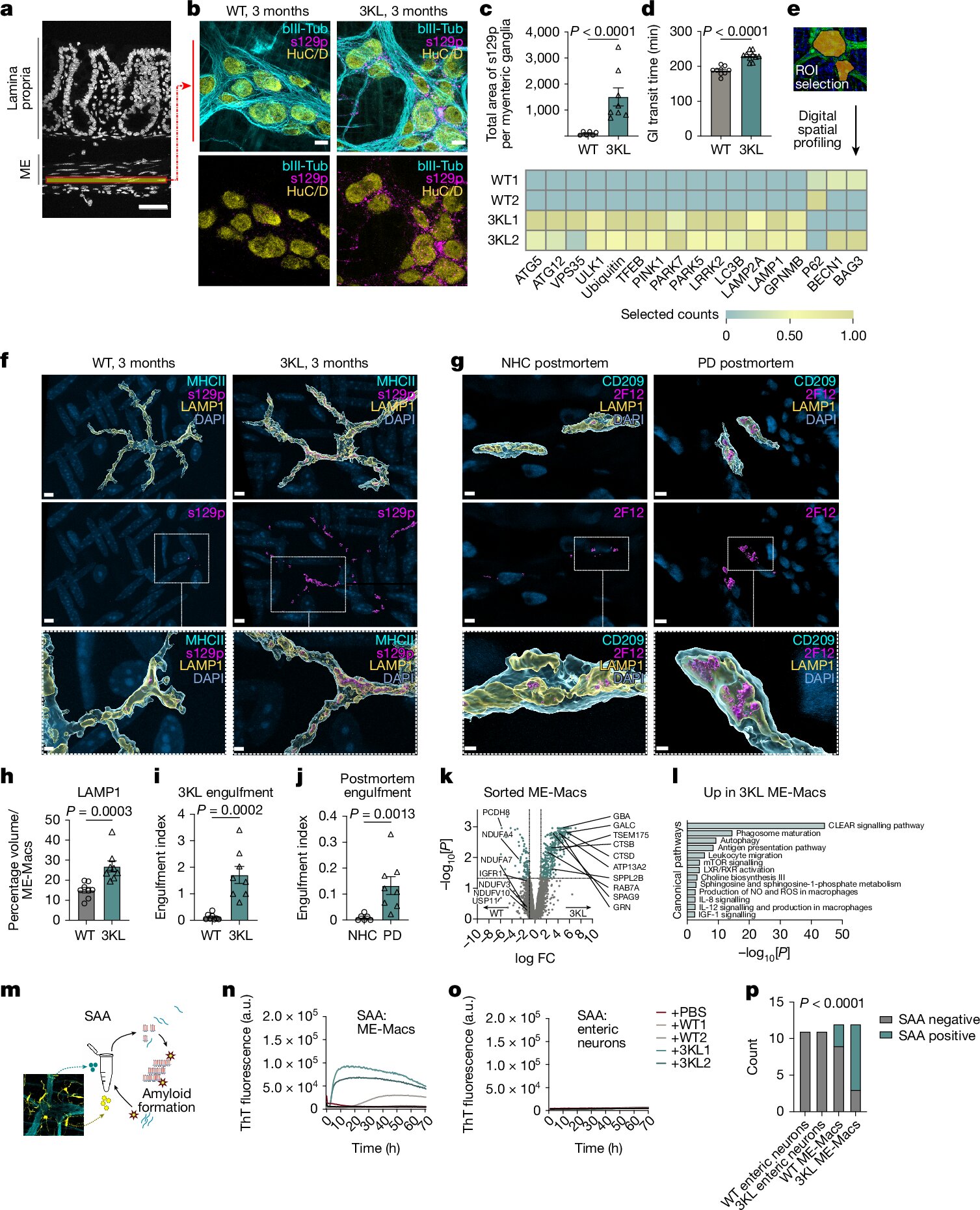 Targeting the gut's immune system could tackle early stages of Parkinson's
