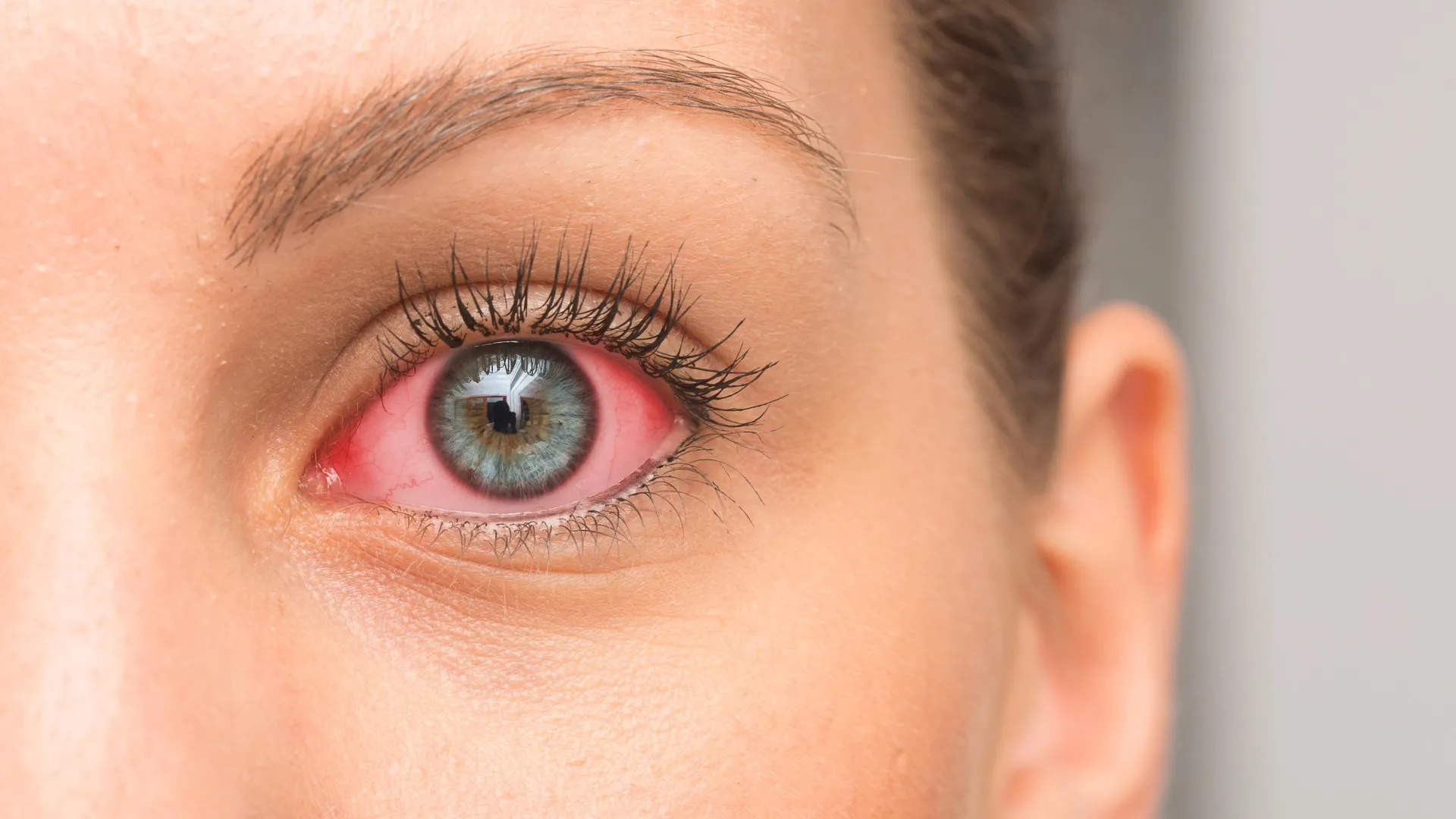 A hidden cellular breakdown may be driving dry eye disease