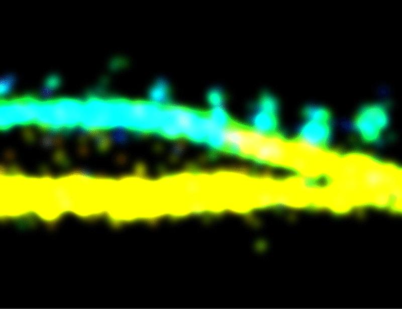 Actin depolymerization promotes axon regeneration by restoring axonal mitochondrial transport in mouse models of optic neuropathy | Science Translational Medicine
