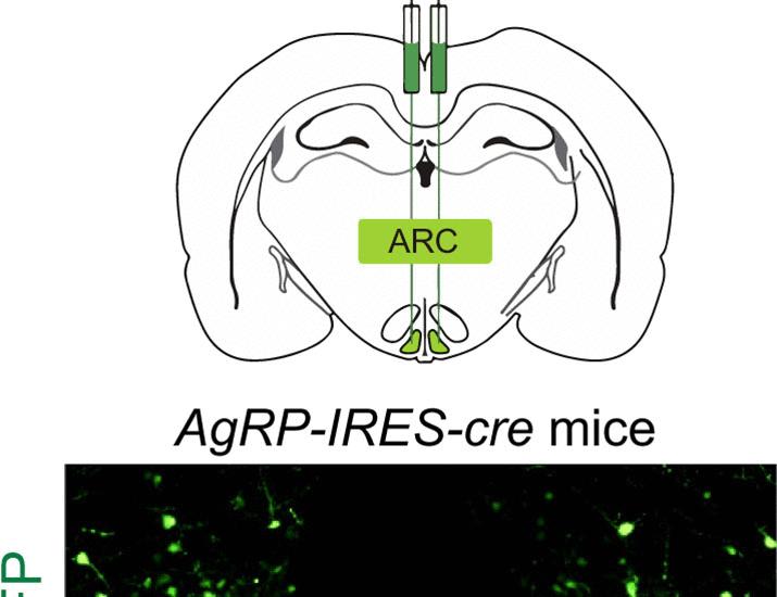 The TUB variant impairs leptin sensitivity and AgRP neuronal response, leading to obesity | Science Translational Medicine